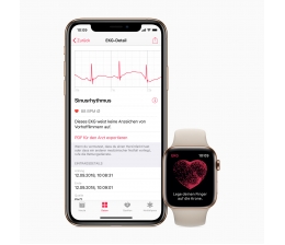 Apple Apple Watch ab sofort auch in Deutschland als EKG nutzbar - Herzrhythmus im Blick, Bild 1 mobile Devices Apple Watch ab sofort auch in Deutschland als EKG nutzbar - Herzrhythmus im Blick - News, Bild 1