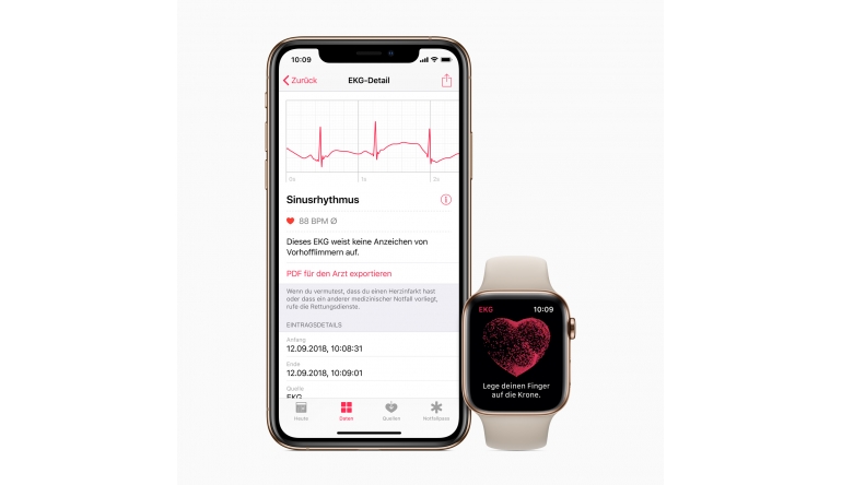 Apple Apple Watch ab sofort auch in Deutschland als EKG nutzbar - Herzrhythmus im Blick, Bild 1 mobile Devices Apple Watch ab sofort auch in Deutschland als EKG nutzbar - Herzrhythmus im Blick - News, Bild 1